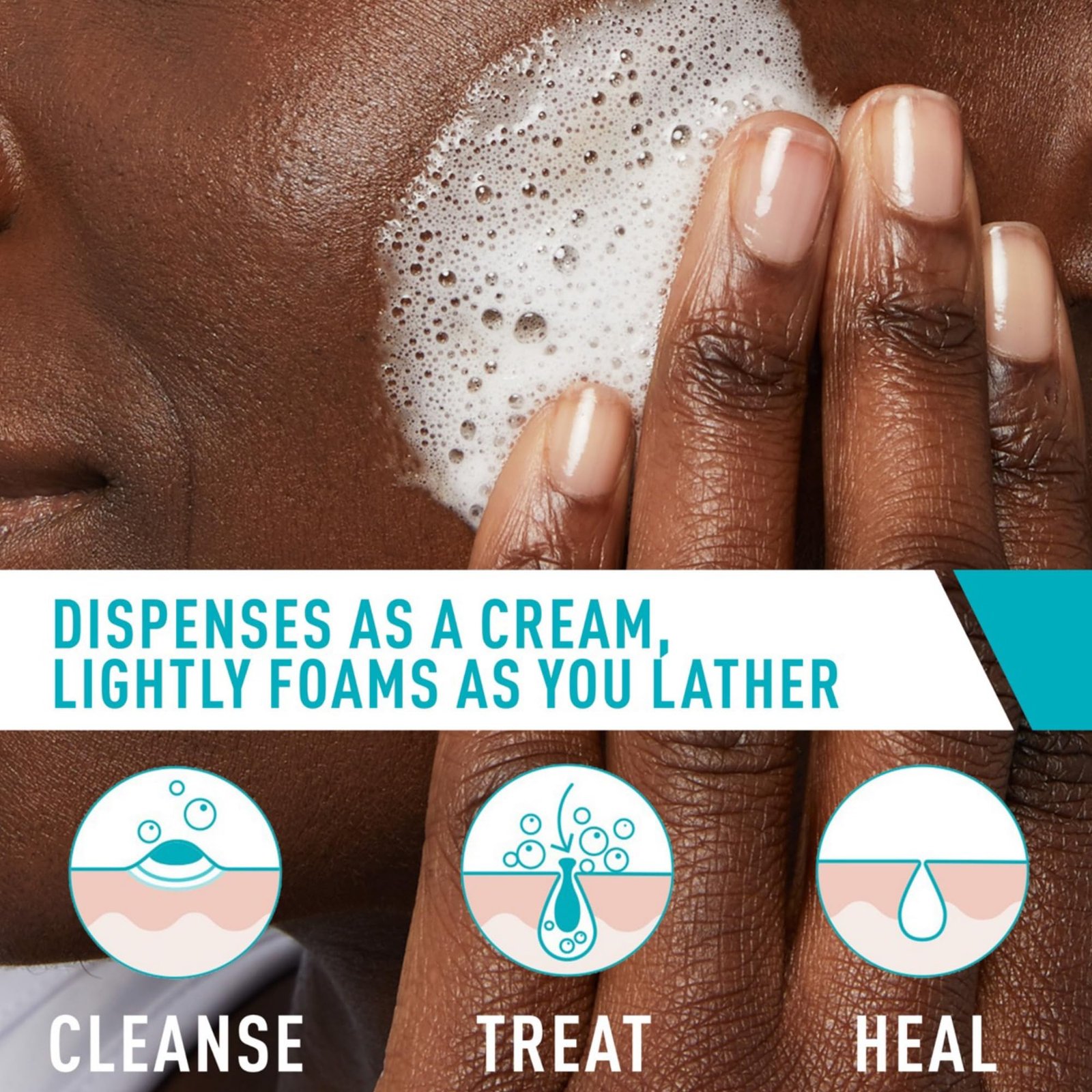 CeraVe Acne Foaming Cream Cleanser 150ml — view 4 of 7