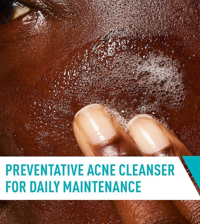 CeraVe Acne Control Cleanser 237ml — view 4 of 6